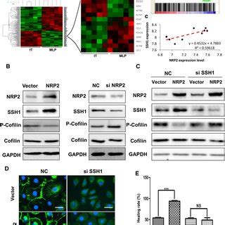 Nrp Expression Is Positively Correlated With Pnet Vascularity A