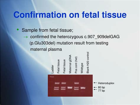 PPT Non Invasive Prenatal Sex Determination Single Gene Disorder Testing Using Cell Free DNA