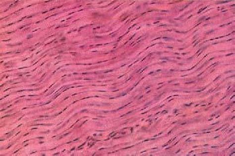 Dense Connective Tissue – Earth's Lab