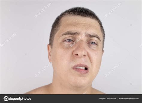 man sweating  face  camera sweat gland problems hyperhidrosis