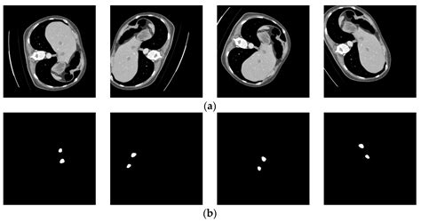 Applied Sciences Free Full Text Liver Tumor Computed Tomography