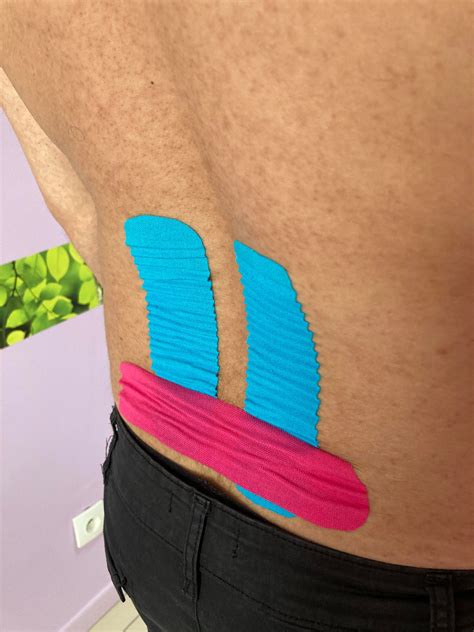 Comment Le Taping Peut Il être Une Technique De Traitement Efficace
