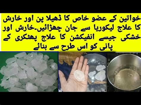 How To Tighten Loose Vagina Normal Delivery Ka Bad Part Ko Tight Krna Ka Tariqa Vagina