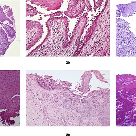 Classic Hande Stain Histopathological Findings Under 20x Magnification Download Scientific