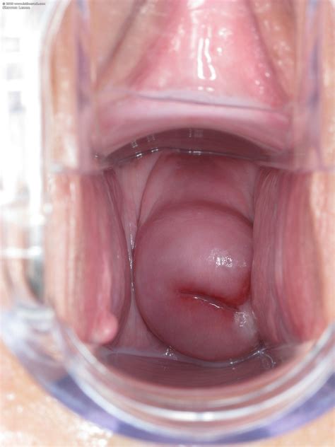 Erotic Porn In The Crack XXX Dessert Picture