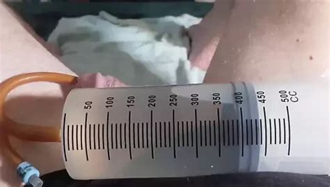 Catheter Insertion Bladder Filling And Ball Torture Gay Amateur Amateur Porn Xhamster