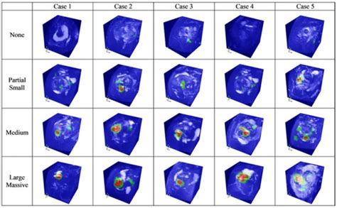 Zeldas Reaction To Anal