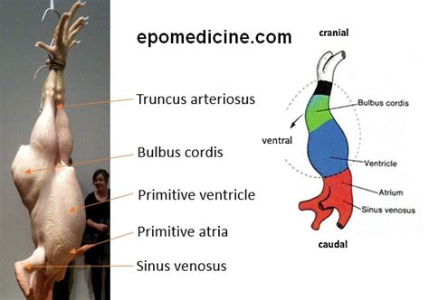 Heart Development Embryology Made Easy Epomedicine