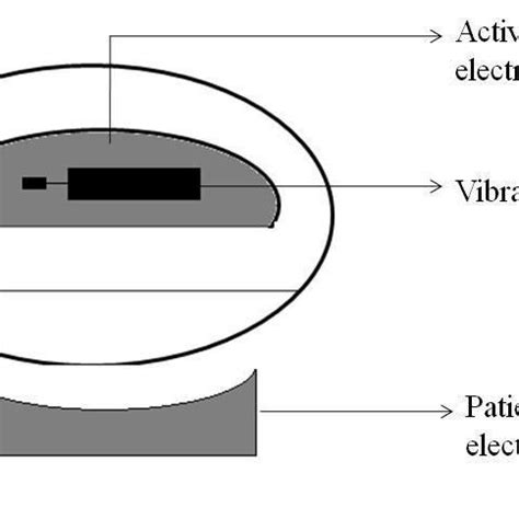placement  electrodes   vibrator   closed eye