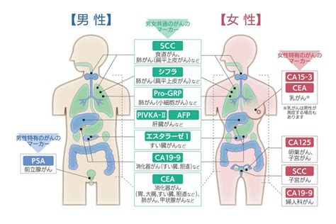 腫瘍マーカー検査とは、どんな検査？ ミッドタウンクリニック名駅｜jpタワー名古屋の人間ドック・健康診断