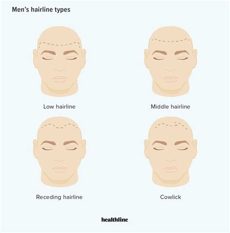 Hairline Types For Men And Women Plus How To Change Your Type Men