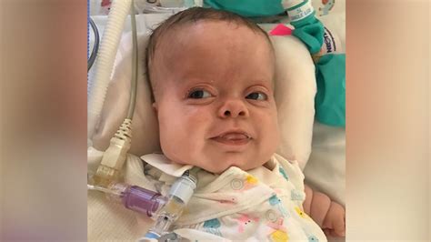 Baby With Rare Dwarfism Goes Home After 184 Days In Hospital Good