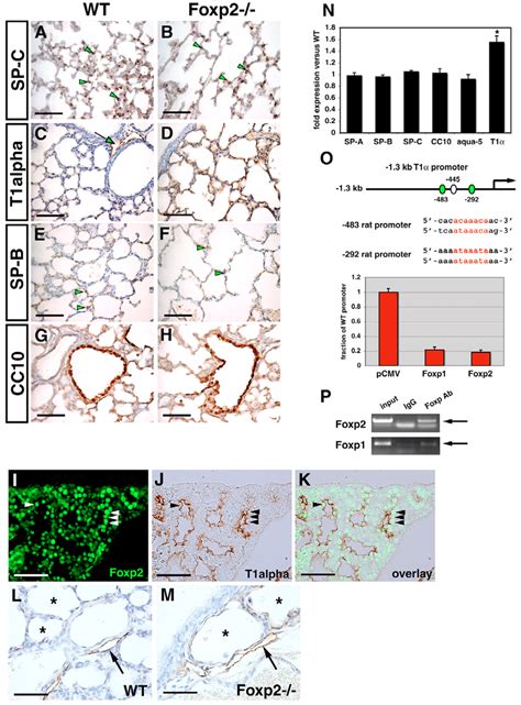 T Alpha Is A Direct In Vivo Target Of Foxp And Foxp In The Lung