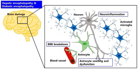 Ijms Free Full Text The Association Between Hepatic Encephalopathy