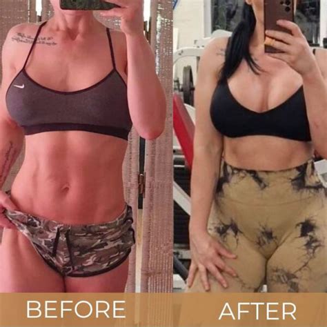 How Much Is A Boob Job Breast Surgery Implant Cost