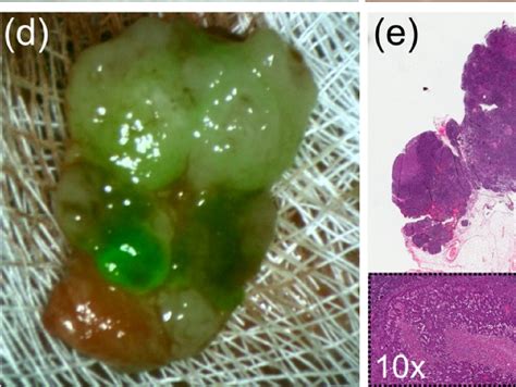 [pdf] Sentinel Lymph Node Mapping Using Icg Fluorescence And Cone Beam