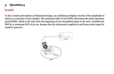 Solved In The A Mode Presentation Of Ultrasound Images An Chegg