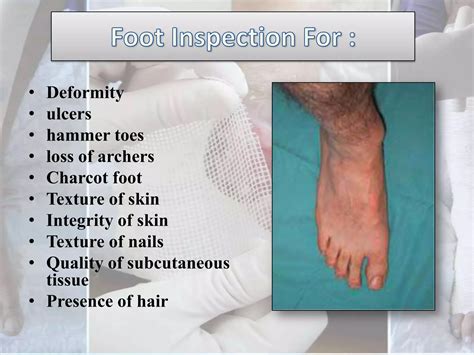 Diabetic Foot Examination | PPTX