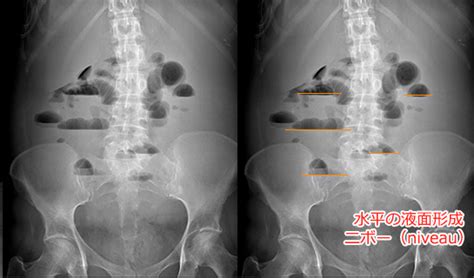 radiographica