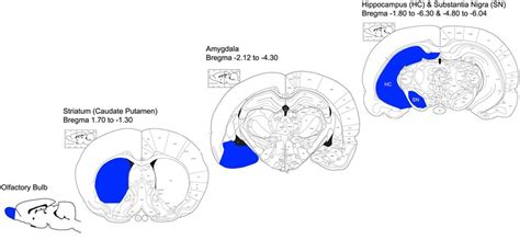 Anatomical Representation Of Dissected Brain Regions Adapted From The