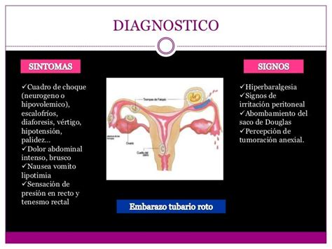 Embarazo Ectopico Y A Espon