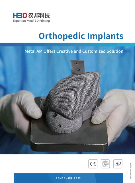 Metal 3D Printing Orthopedic Implants — — Metal AM offers Creative and