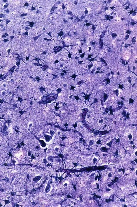 glial cells light micrograph stock image  science photo