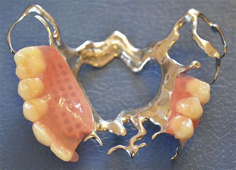 Базовий курс: Техніка виготовлення бюгельних протезів – Про зуби