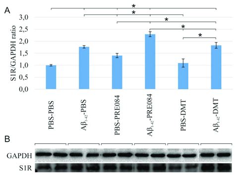 A Results For The Western Blot Wb Analysis Significant Differences