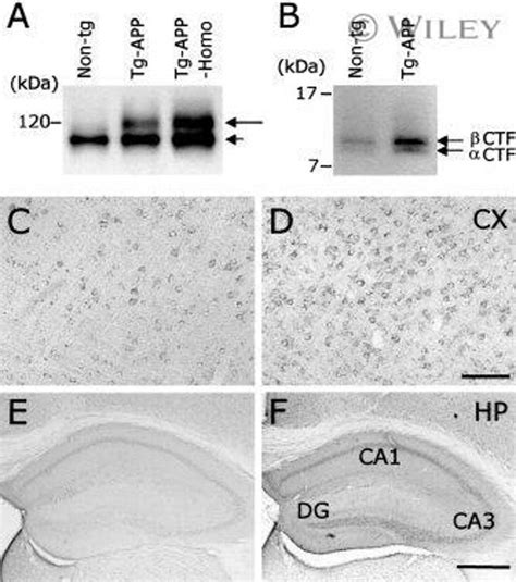 Amyloid Precursor Protein Monoclonal Antibody Ln27 13 0200