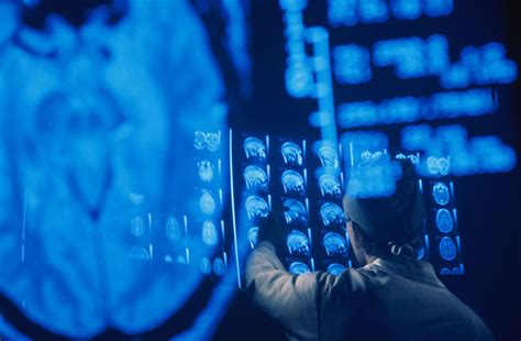 comas work howstuffworks