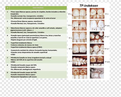 Advertising Dental Fluorosis Dentistry Brochure Indice Text