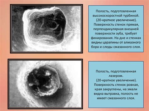 Применение лазерных технологий в стоматологии - презентация онлайн