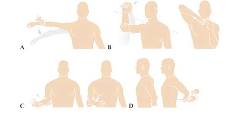 Supraspinatus Test