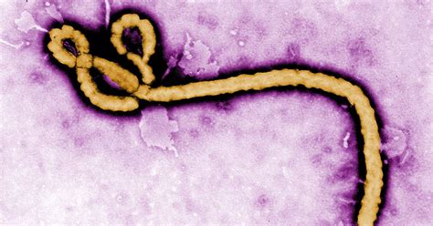 Ebola Survivor Transmits Virus To His Partner Through Unprotected Sex In First Known Case Of Its