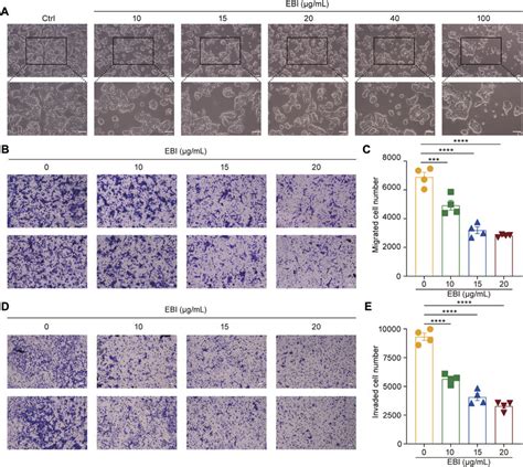 EBI suppresses growth, migration, and invasion of SW620 cells. (A ...