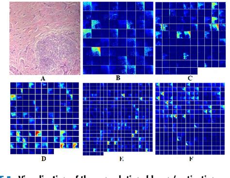 Classification Of Breast Cancer Based On Histology Images Using