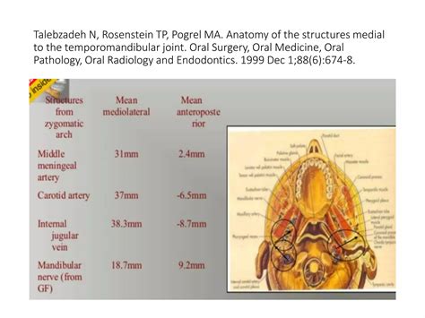 Temporomandibular Joint Ankylosis And Its Management Ppt