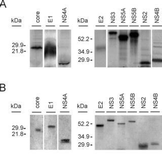 Correlation Of Anti HCV Antibody Patterns By Western Blot Analysis And