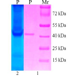 1 12 W V SDS PAGE And 2 Zymography Of Purified Chitinase From