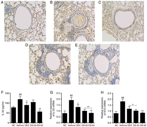 Osthole Attenuates Ovalbumininduced Lung Inflammation Via The