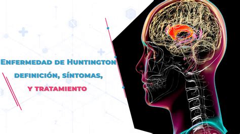 Enfermedad de Huntington Qué es síntomas y tratamiento