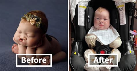 The Heart Warming Story Of One Photograph An Image Of A Baby With A