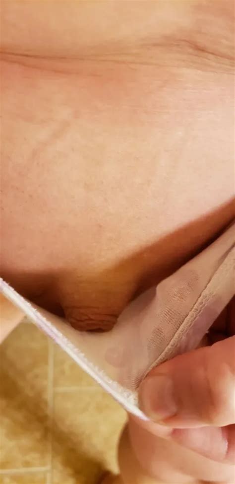 Tiny Cock Micropenis Small Dick Nude Pics XHamster