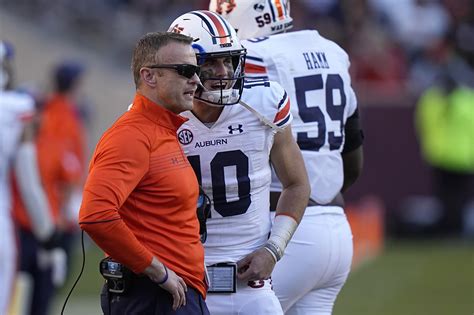 Auburn's Carlson out for season; Nix has successful surgery | AP News