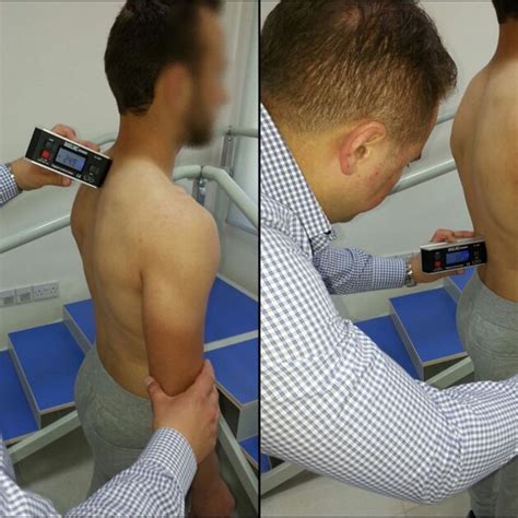 The Measurement Of The Thoracic Kyphosis Angle With The Digital