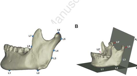 Figure 1 From Sex Determination From The Mandibular Ramus Flexure Of