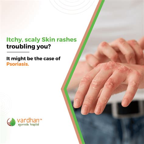 Itchy, scaly Skin rashes troubling you? It might be the case of ...