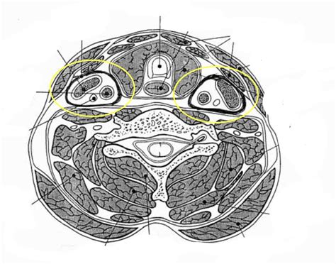 carotid sheath Diagram | Quizlet