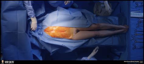 Anne Dorval Nude Pics Page